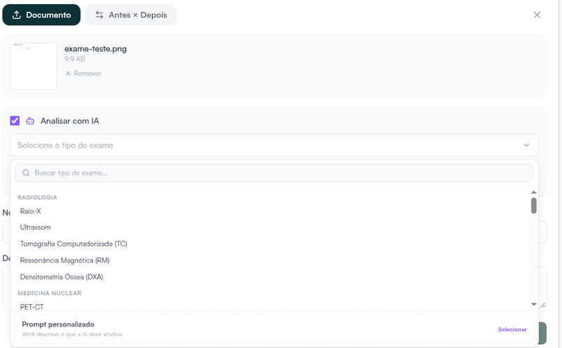 Anexo com Analisar com IA marcado e a lista de tipos de exame, com a opção Prompt personalizado